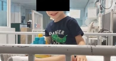 España. Terminó primera operación de Oliver, niño con tumor cerebral