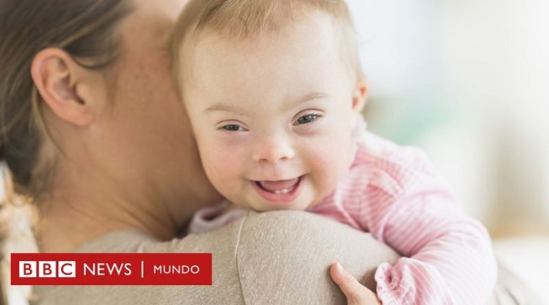 La drástica caída de nacimientos de bebés con síndrome de Down en Europa (y el debate que genera) - BBC News Mundo