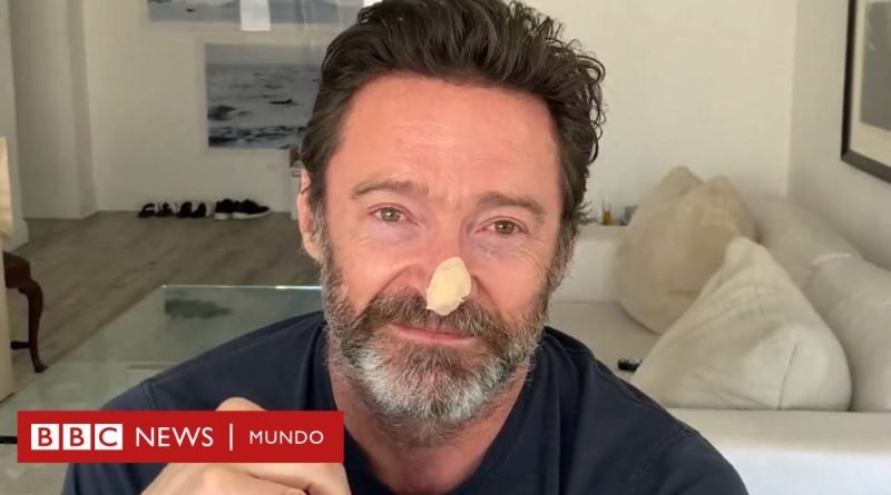 La imagen con la que Hugh Jackman muestra que se sometió a otra biopsia y alerta sobre el cáncer de piel - BBC News Mundo