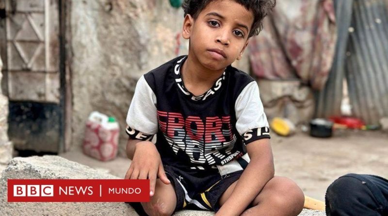 Guerra en Yemen | 