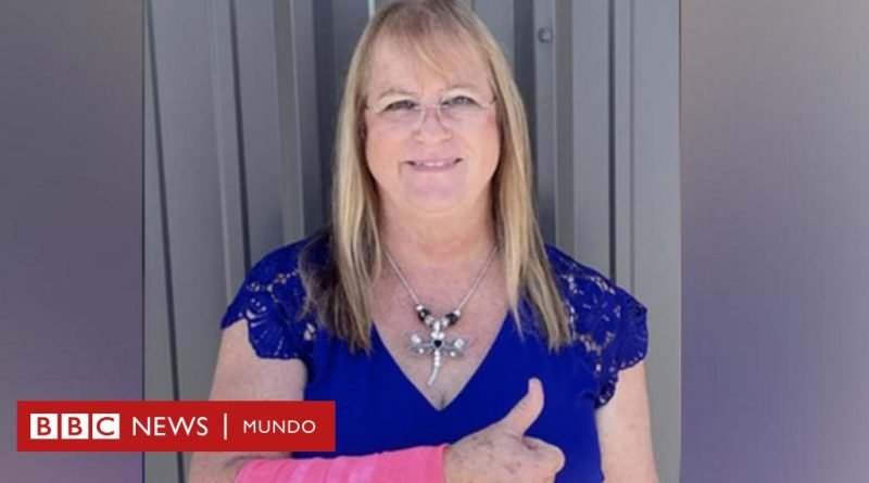 Una mujer en Texas resulta herida luego de que un halcón dejara caer una serpiente sobre ella  - BBC News Mundo