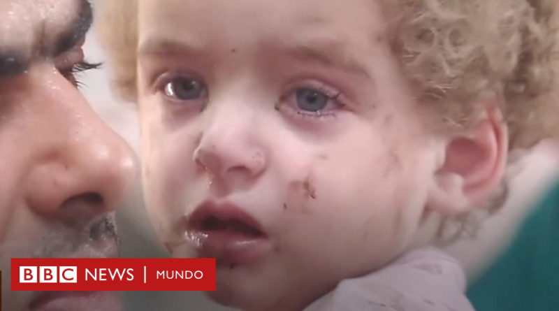 Guerra Israel - Hamás | Video: el hospital de Gaza desbordado con la llegada de niños heridos - BBC News Mundo