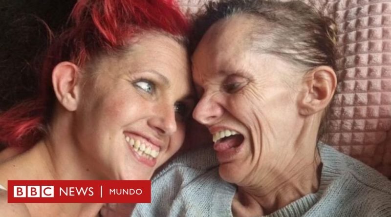 Neuroferritinopatía: la esperanza de una cura para 4 hermanas que viven atrapadas en sus cuerpos - BBC News Mundo