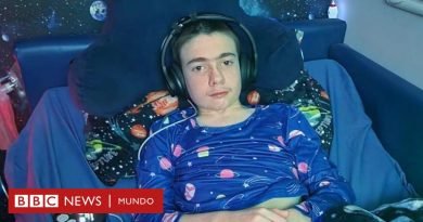 Epilepsia: cómo funciona el dispositivo implantado por primera vez en el mundo en el cráneo de un niño para controlar este mal - BBC News Mundo