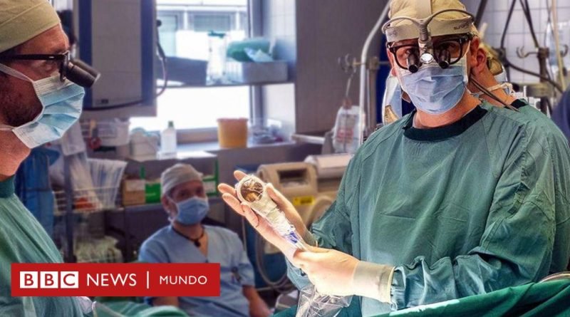 Corazón: “secador de pelo espacial” que ayuda a regenerar el tejido cardíaco después de una operación - BBC News Mundo