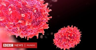 Mpox: cuán grave es el brote actual y otras 4 preguntas sobre la enfermedad que ha forzado a la OMS a declarar una “emergencia sanitaria internacional” - BBC News Mundo