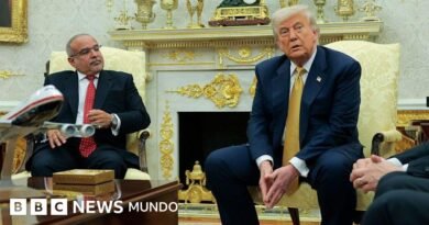 La enfermedad crónica de las venas que le diagnosticaron a Trump - BBC News Mundo