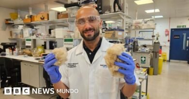 Cómo una crema dental hecha de tu propio pelo podría reparar tu dentadura - BBC News Mundo