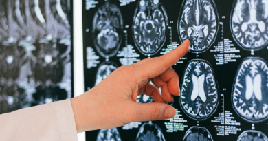 Neurocirujanos: las manos que operan el cerebro y sostienen la vida en silencio