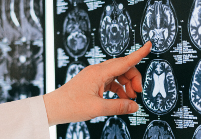 Neurocirujanos: las manos que operan el cerebro y sostienen la vida en silencio