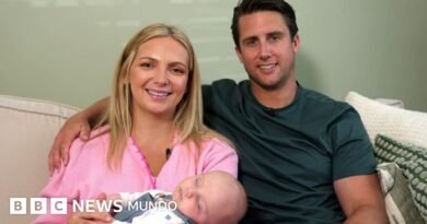 La pionera cirugía de útero a la que se sometió una mujer embarazada cuyo bebé crecía con los intestinos fuera de su cuerpo - BBC News Mundo
