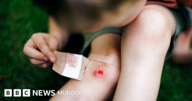 Mercurocromo, el antiséptico con el que curaron las heridas de millones de niños en todo el mundo y terminó prohibido - BBC News Mundo