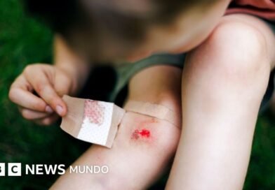 Mercurocromo, el antiséptico con el que curaron las heridas de millones de niños en todo el mundo y terminó prohibido - BBC News Mundo