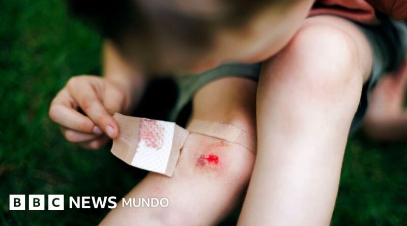 Mercurocromo, el antiséptico con el que curaron las heridas de millones de niños en todo el mundo y terminó prohibido - BBC News Mundo
