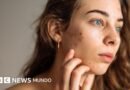 5 consejos de expertos para cuidar la piel adolescente y evitar rutinas que pueden afectarla - BBC News Mundo