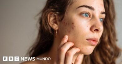5 consejos de expertos para cuidar la piel adolescente y evitar rutinas que pueden afectarla - BBC News Mundo