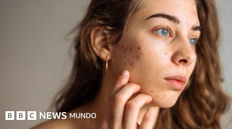 5 consejos de expertos para cuidar la piel adolescente y evitar rutinas que pueden afectarla - BBC News Mundo
