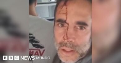 Las imágenes dentro del avión con destino a Israel en el que apuñalaron a un piloto - BBC News Mundo