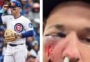 Por distraído: Alex Bregman, pelotero de Cachorros, sufre impactante pelotazo en la cara - RR Noticias