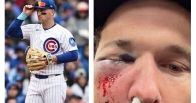 Por distraído: Alex Bregman, pelotero de Cachorros, sufre impactante pelotazo en la cara - RR Noticias