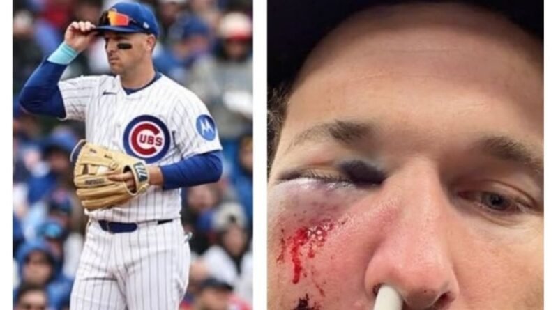Por distraído: Alex Bregman, pelotero de Cachorros, sufre impactante pelotazo en la cara - RR Noticias
