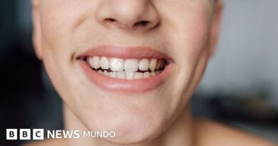 Qué debes comer para proteger las bacterias beneficiosas de tu boca - BBC News Mundo