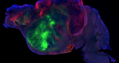 Ratones con millones de neuronas humanas en su cerebro acercan la respuesta a enfermedades mentales