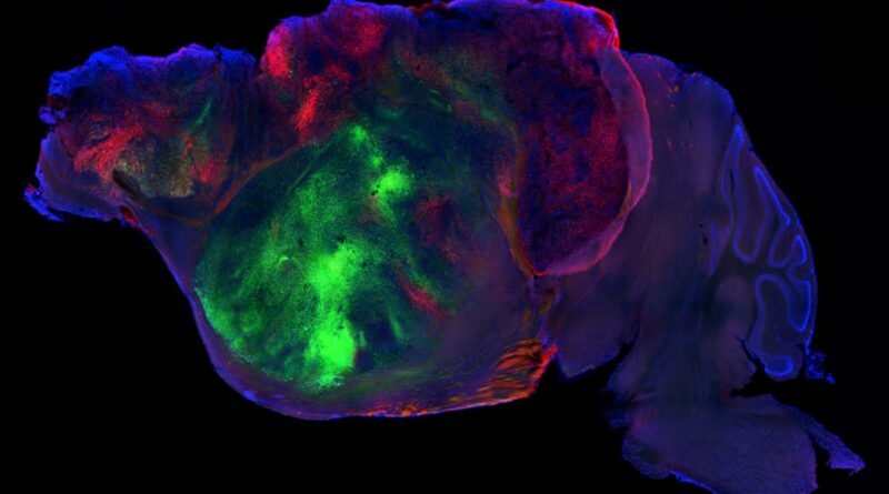 Ratones con millones de neuronas humanas en su cerebro acercan la respuesta a enfermedades mentales