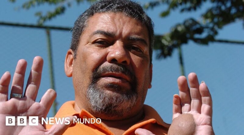 Mi hermano compró una brillante cápsula azul sin saber que era cesio-137 y desató el mayor accidente radiactivo de la historia de mi país - BBC News Mundo