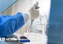 Qué es y cómo se propaga la peste neumónica que se estudia en el laboratorio de Siberia en el que falleció una trabajadora - BBC News Mundo