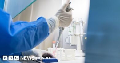 Qué es y cómo se propaga la peste neumónica que se estudia en el laboratorio de Siberia en el que falleció una trabajadora - BBC News Mundo